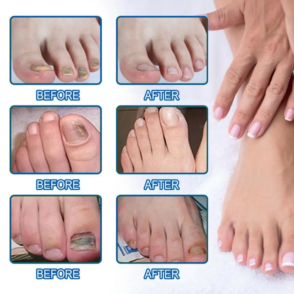 Professional Nail Repair Solution Quick Fix for Breakage Delamination Long Lasting Protection Gentle Formula Fast Drying