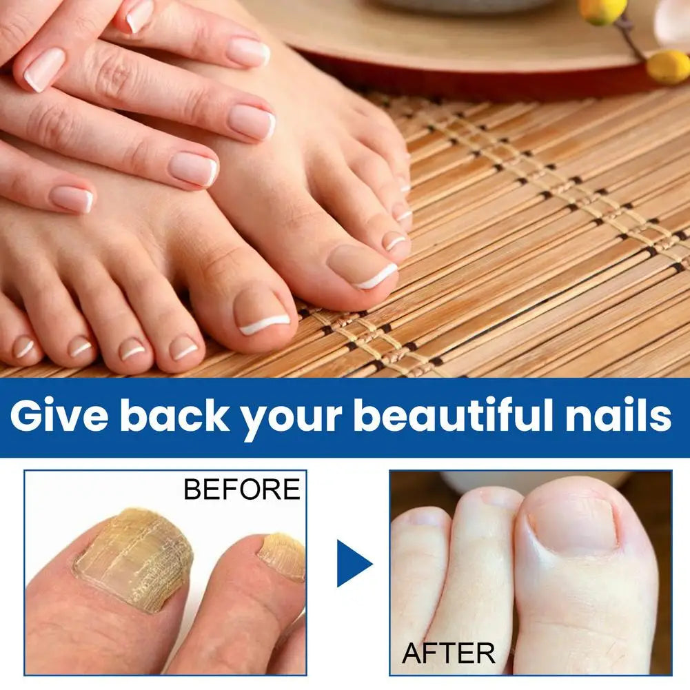 Professional Nail Repair Solution Quick Fix for Breakage Delamination Long Lasting Protection Gentle Formula Fast Drying