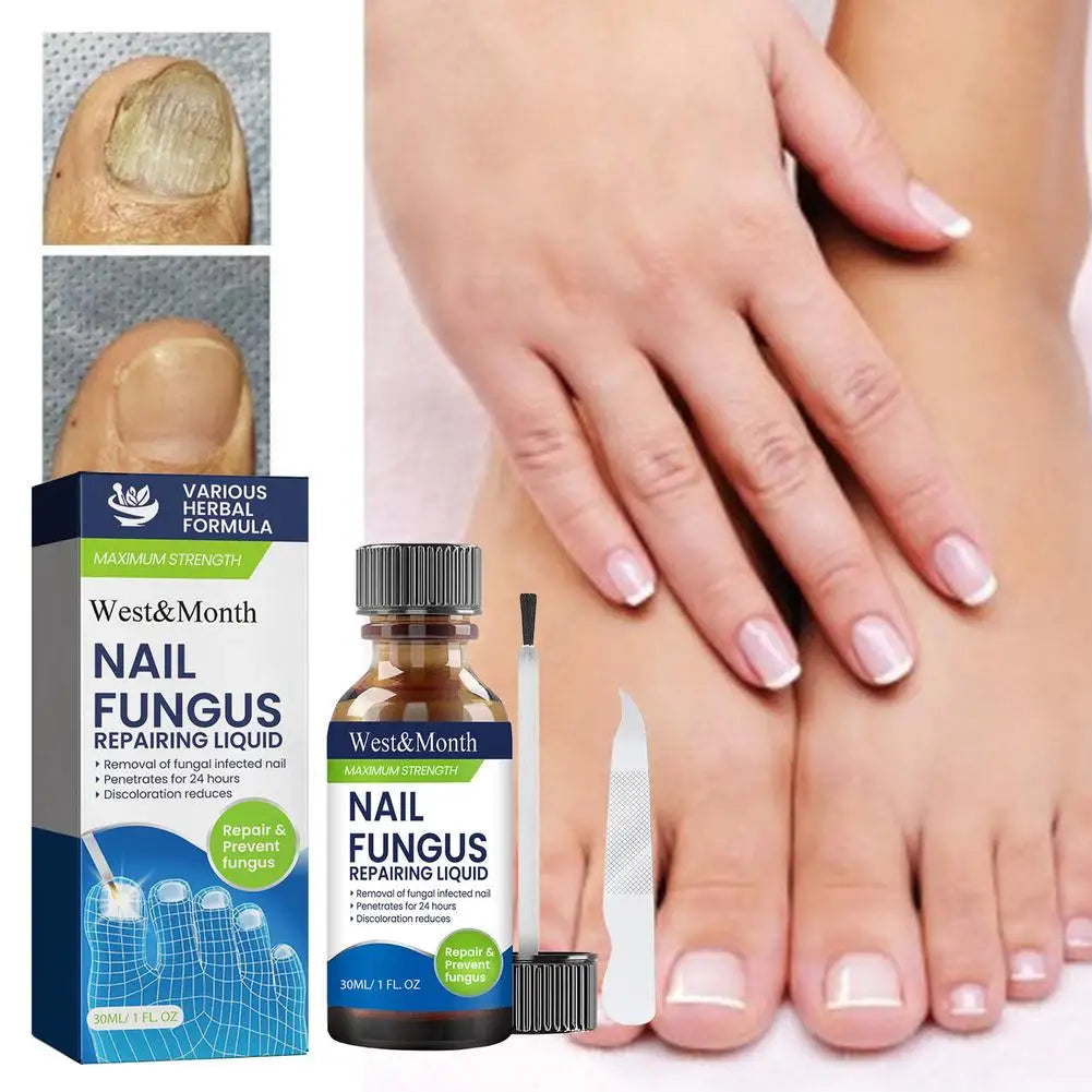 Professional Nail Repair Solution Quick Fix for Breakage Delamination Long Lasting Protection Gentle Formula Fast Drying